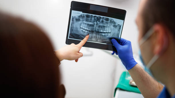 Рентген зубов: всё, что вам необходимо знать о процедуре